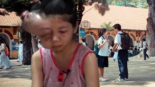 Nổi Đau Của Nữ Sinh Nghèo Trường Marie Curie Bị Khối U